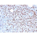 Immunohistochemistry - Anti-MiTF Antibody [MITF/2987R] - BSA and Azide free (A252520) - Antibodies.com