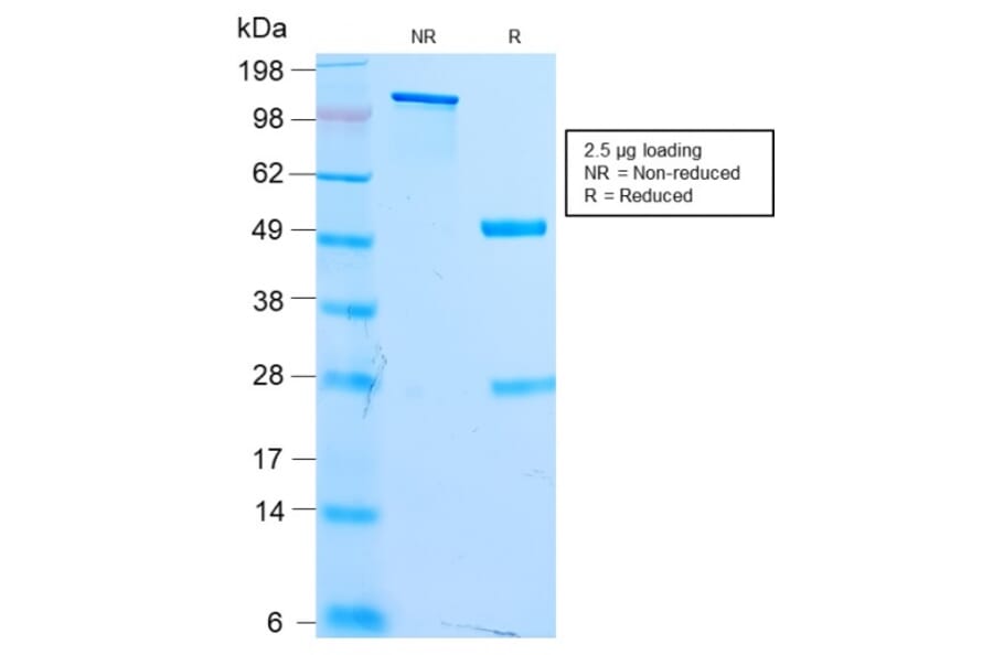 SDS-PAGE - Anti-MiTF Antibody [MITF/2987R] - BSA and Azide free (A252521) - Antibodies.com