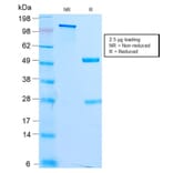 SDS-PAGE - Anti-MiTF Antibody [MITF/2987R] - BSA and Azide free (A252521) - Antibodies.com