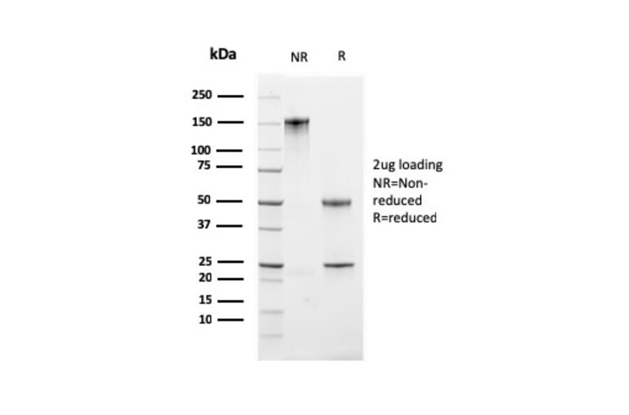 SDS-PAGE - Anti-Ki67 Antibody [MKI67/2461] - BSA and Azide free (A252522) - Antibodies.com
