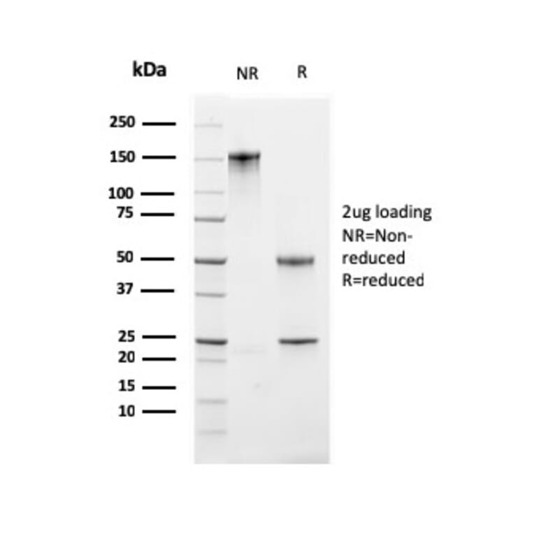 SDS-PAGE - Anti-Ki67 Antibody [MKI67/2461] - BSA and Azide free (A252522) - Antibodies.com