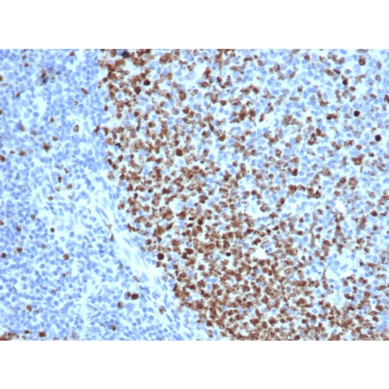 Immunohistochemistry - Anti-Ki67 Antibody [rMKI67/6615] - BSA and Azide free (A252524) - Antibodies.com