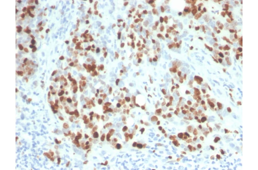 Immunohistochemistry - Anti-Ki67 Antibody [rMKI67/6615] - BSA and Azide free (A252523) - Antibodies.com