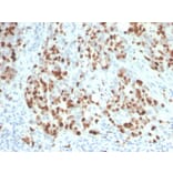 Immunohistochemistry - Anti-Ki67 Antibody [rMKI67/6615] - BSA and Azide free (A252523) - Antibodies.com