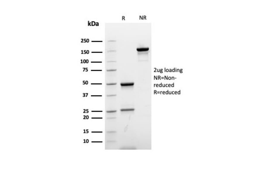 SDS-PAGE - Anti-Ki67 Antibody [rMKI67/6615] - BSA and Azide free (A252524) - Antibodies.com