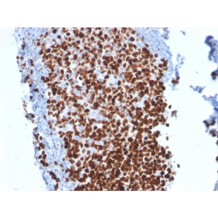Immunohistochemistry - Anti-Ki67 Antibody [MKI67/2462] - BSA and Azide free (A252525) - Antibodies.com