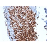 Immunohistochemistry - Anti-Ki67 Antibody [MKI67/2462] - BSA and Azide free (A252525) - Antibodies.com