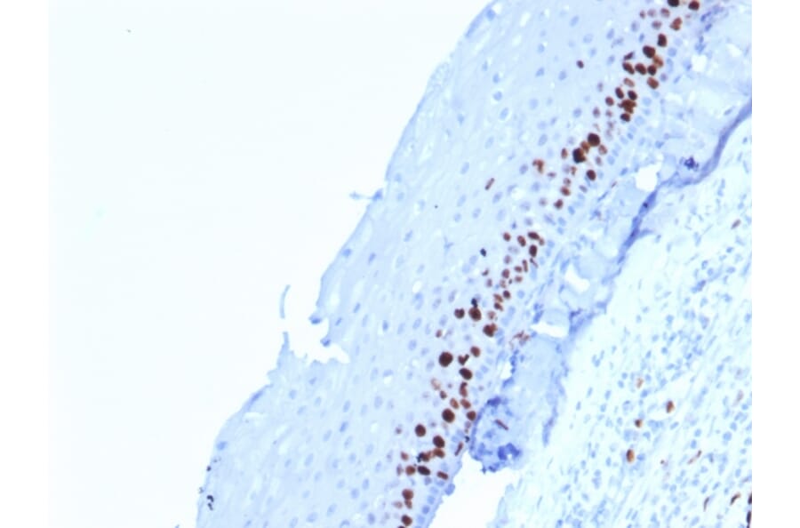 Immunohistochemistry - Anti-Ki67 Antibody [MKI67/2462] - BSA and Azide free (A252525) - Antibodies.com
