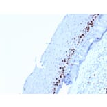 Immunohistochemistry - Anti-Ki67 Antibody [MKI67/2462] - BSA and Azide free (A252525) - Antibodies.com