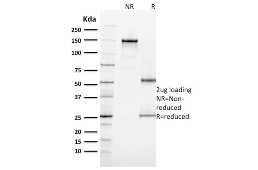 SDS-PAGE - Anti-Ki67 Antibody [MKI67/2462] - BSA and Azide free (A252525) - Antibodies.com