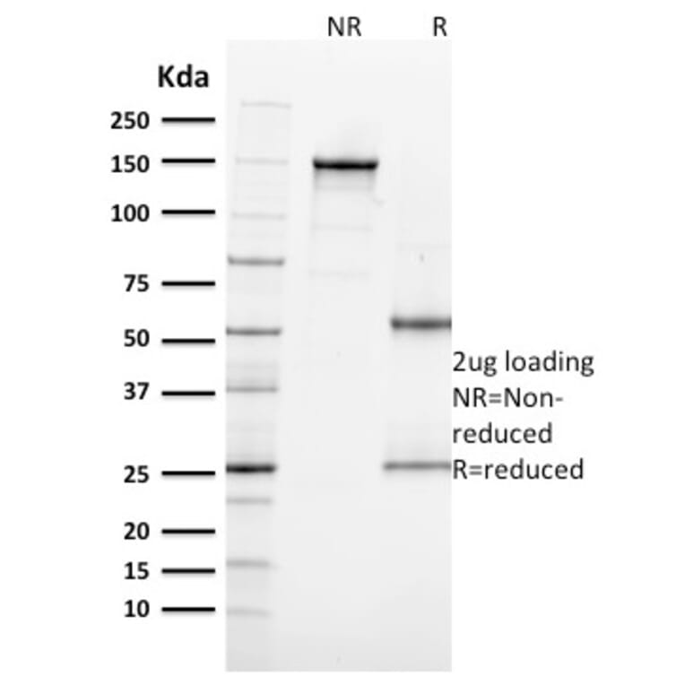 SDS-PAGE - Anti-Ki67 Antibody [MKI67/2462] - BSA and Azide free (A252525) - Antibodies.com