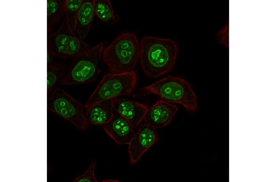 Immunofluorescence - Anti-Ki67 Antibody [MKI67/2462] - BSA and Azide free (A252525) - Antibodies.com