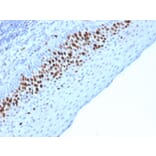 Immunohistochemistry - Anti-Ki67 Antibody [MKI67/2463] - BSA and Azide free (A252526) - Antibodies.com