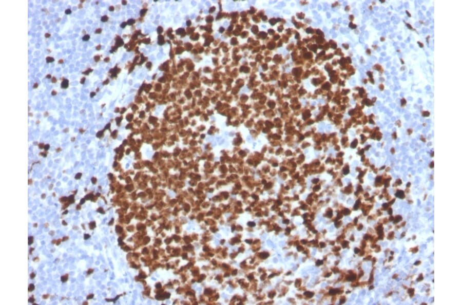 Immunohistochemistry - Anti-Ki67 Antibody [MKI67/2465] - BSA and Azide free (A252527) - Antibodies.com