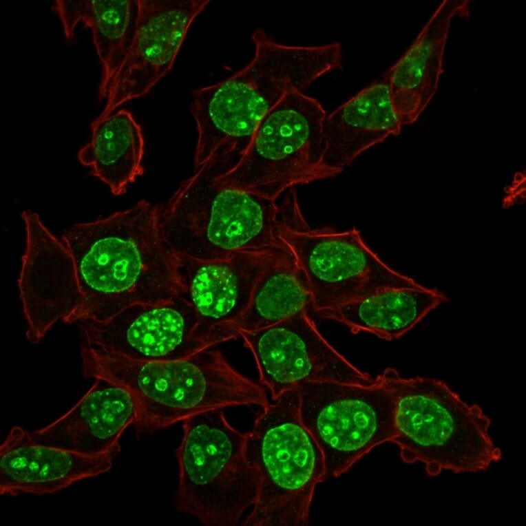 Immunofluorescence - Anti-Ki67 Antibody [MKI67/2465] - BSA and Azide free (A252527) - Antibodies.com