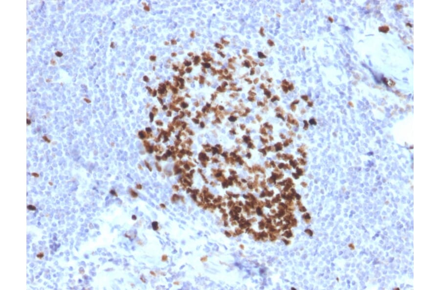 Immunohistochemistry - Anti-Ki67 Antibody [MKI67/2466] - BSA and Azide free (A252528) - Antibodies.com