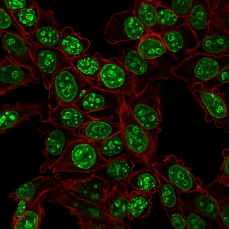 Immunofluorescence - Anti-Ki67 Antibody [MKI67/2466] - BSA and Azide free (A252528) - Antibodies.com