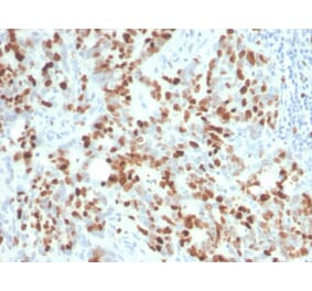 Immunohistochemistry - Anti-Ki67 Antibody [MKI67/4945R] - BSA and Azide free (A252528) - Antibodies.com