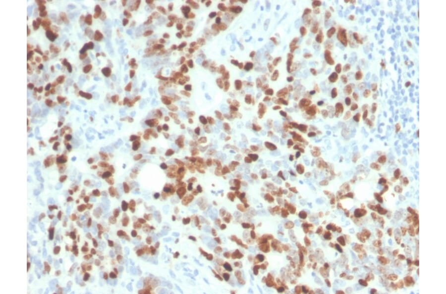 Immunohistochemistry - Anti-Ki67 Antibody [MKI67/4945R] - BSA and Azide free (A252528) - Antibodies.com