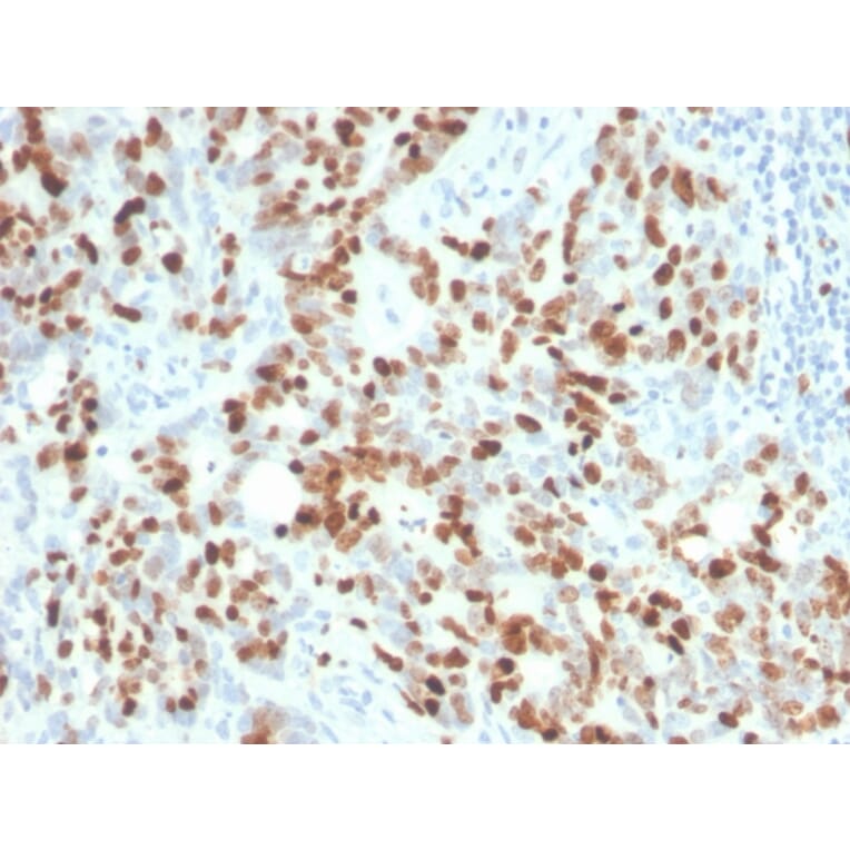 Immunohistochemistry - Anti-Ki67 Antibody [MKI67/4945R] - BSA and Azide free (A252528) - Antibodies.com