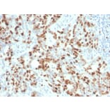 Immunohistochemistry - Anti-Ki67 Antibody [MKI67/4945R] - BSA and Azide free (A252528) - Antibodies.com