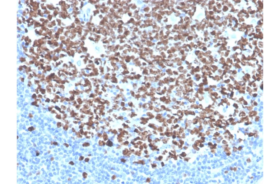 Immunohistochemistry - Anti-Ki67 Antibody [MKI67/4945R] - BSA and Azide free (A252529) - Antibodies.com