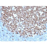 Immunohistochemistry - Anti-Ki67 Antibody [MKI67/4945R] - BSA and Azide free (A252529) - Antibodies.com