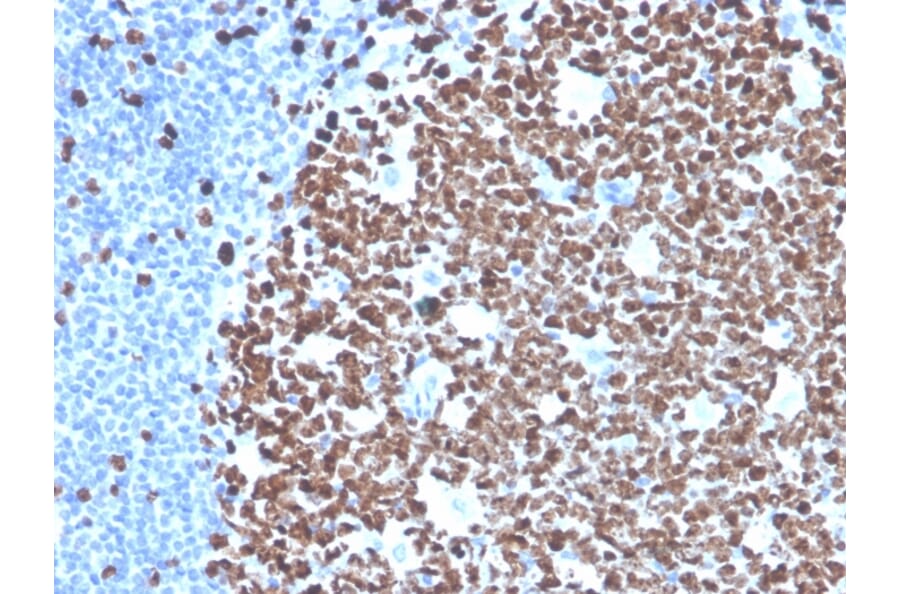 Immunohistochemistry - Anti-Ki67 Antibody [MKI67/4945R] - BSA and Azide free (A252529) - Antibodies.com