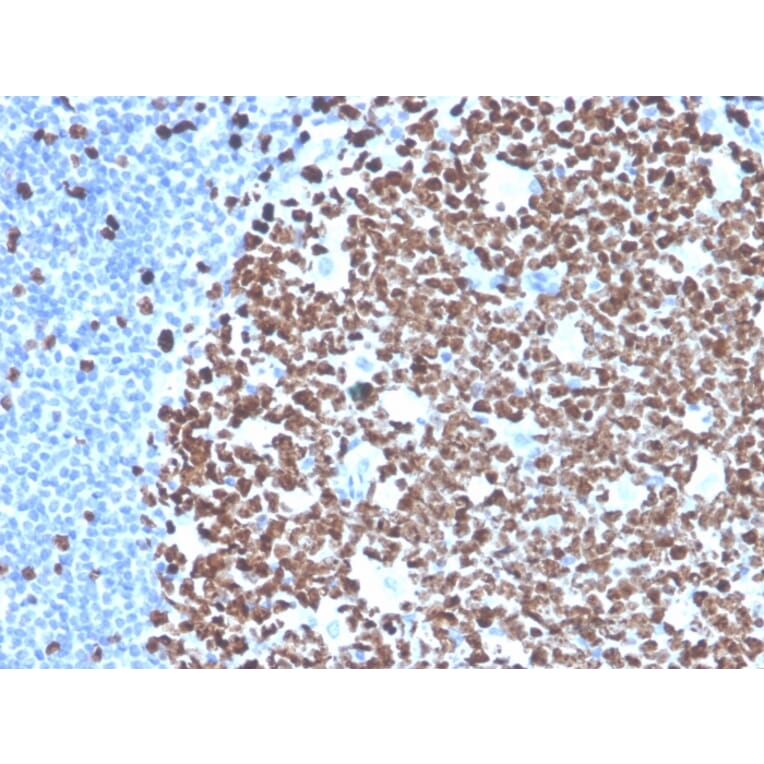 Immunohistochemistry - Anti-Ki67 Antibody [MKI67/4945R] - BSA and Azide free (A252529) - Antibodies.com