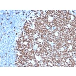 Immunohistochemistry - Anti-Ki67 Antibody [MKI67/4945R] - BSA and Azide free (A252529) - Antibodies.com