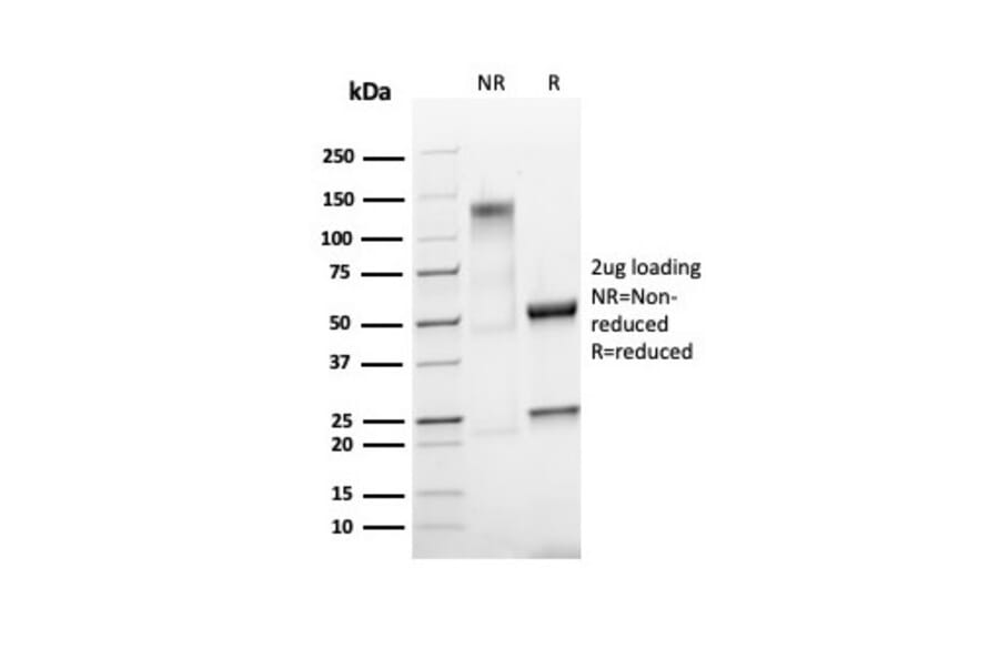 SDS-PAGE - Anti-Ki67 Antibody [MKI67/4945R] - BSA and Azide free (A252529) - Antibodies.com
