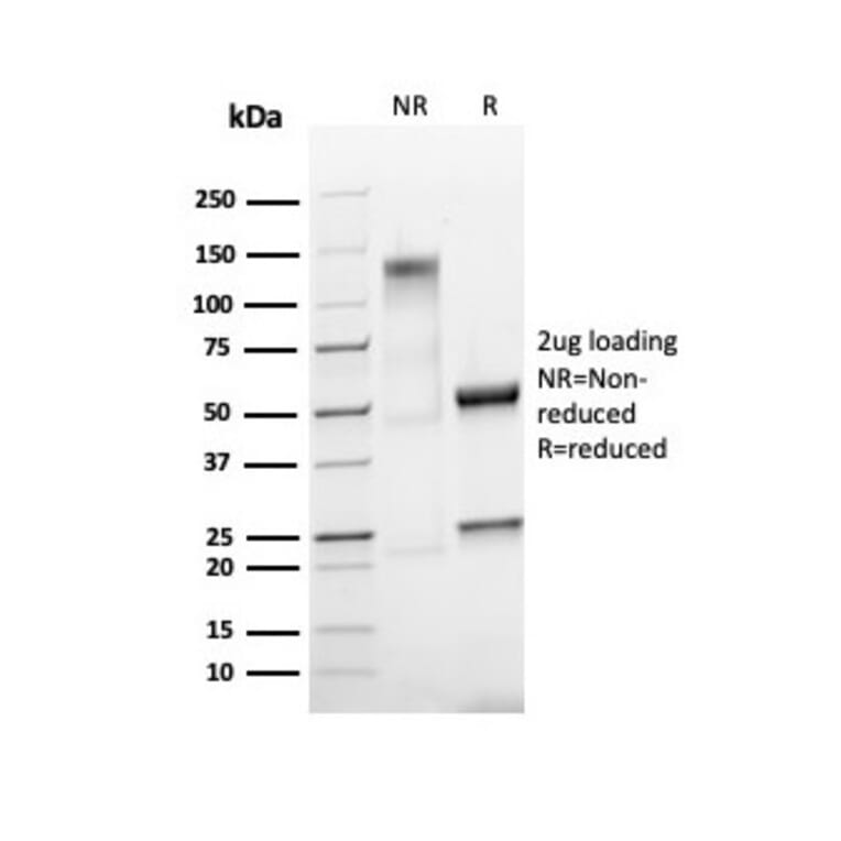SDS-PAGE - Anti-Ki67 Antibody [MKI67/4945R] - BSA and Azide free (A252529) - Antibodies.com