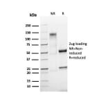 SDS-PAGE - Anti-Ki67 Antibody [MKI67/4945R] - BSA and Azide free (A252529) - Antibodies.com