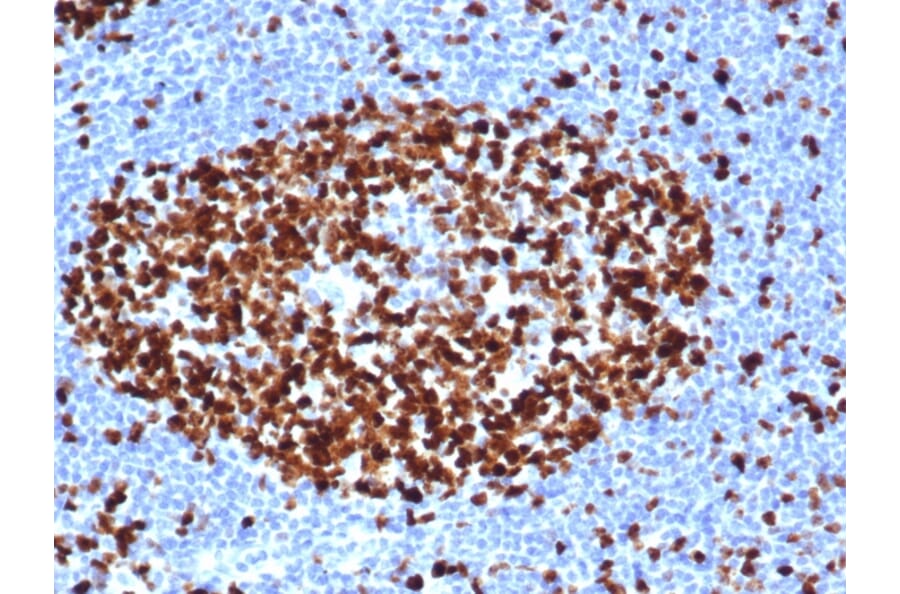 Immunohistochemistry - Anti-Ki67 Antibody [MKI67/6517R] - BSA and Azide free (A252529) - Antibodies.com