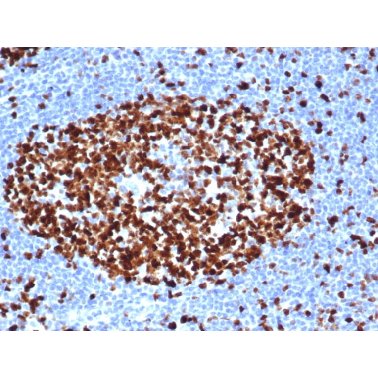 Immunohistochemistry - Anti-Ki67 Antibody [MKI67/6517R] - BSA and Azide free (A252529) - Antibodies.com