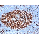 Immunohistochemistry - Anti-Ki67 Antibody [MKI67/6517R] - BSA and Azide free (A252529) - Antibodies.com