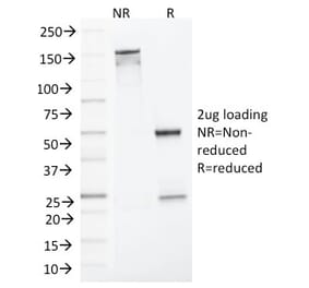 SDS-PAGE - Anti-MLH1 Antibody [MLH1/1324] - BSA and Azide free (A252530) - Antibodies.com