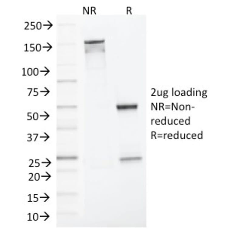 SDS-PAGE - Anti-MLH1 Antibody [MLH1/1324] - BSA and Azide free (A252530) - Antibodies.com