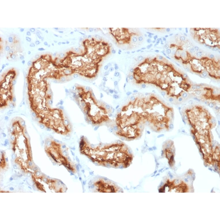 Immunohistochemistry - Anti-CD10 Antibody [MME/1870] - BSA and Azide free (A252533) - Antibodies.com