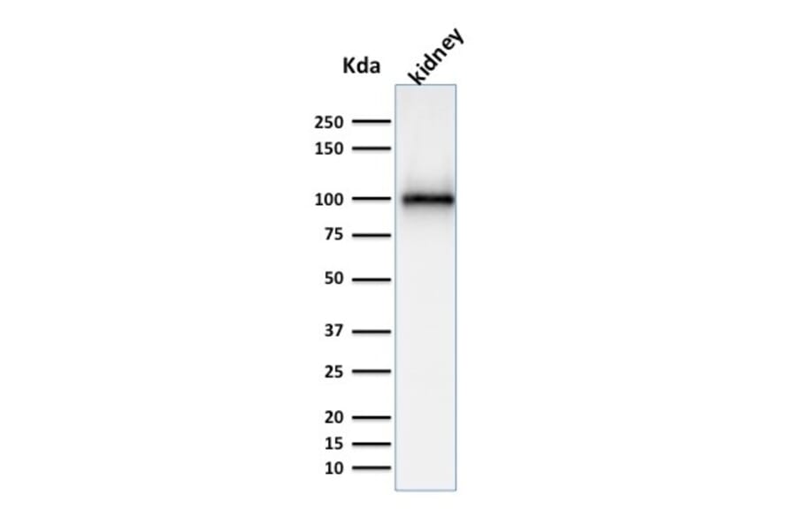 Western Blot - Anti-CD10 Antibody [MME/1870] - BSA and Azide free (A252533) - Antibodies.com