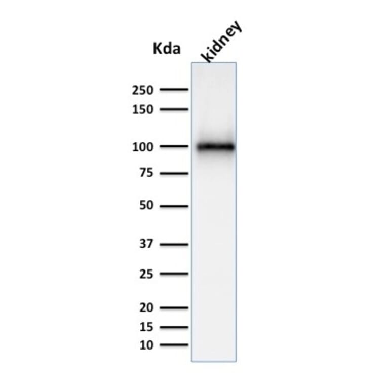 Western Blot - Anti-CD10 Antibody [MME/1870] - BSA and Azide free (A252533) - Antibodies.com