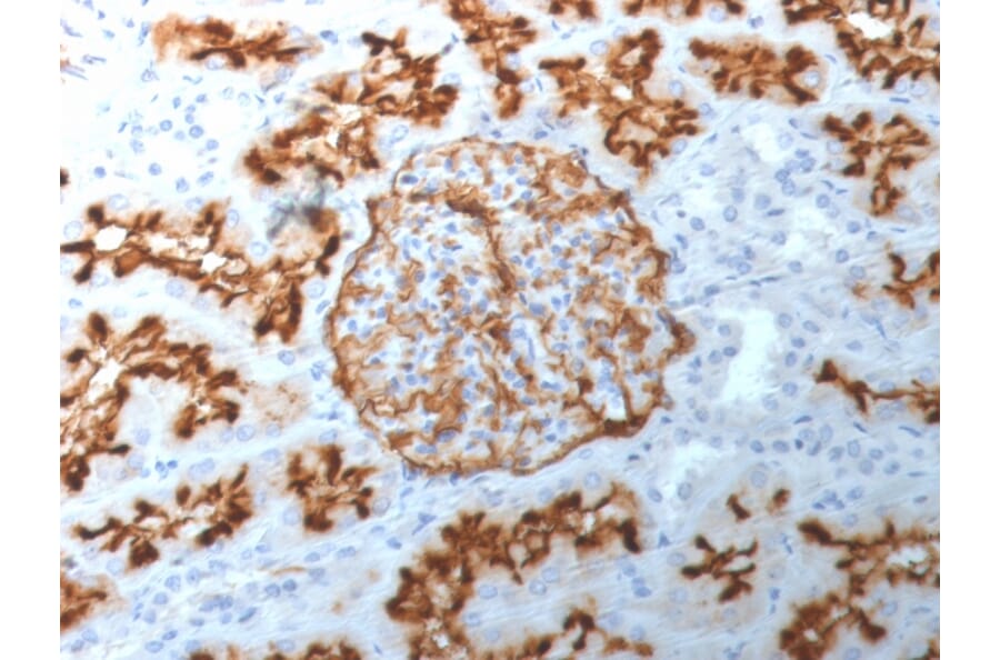 Immunohistochemistry - Anti-CD10 Antibody [MME/1892] - BSA and Azide free (A252535) - Antibodies.com