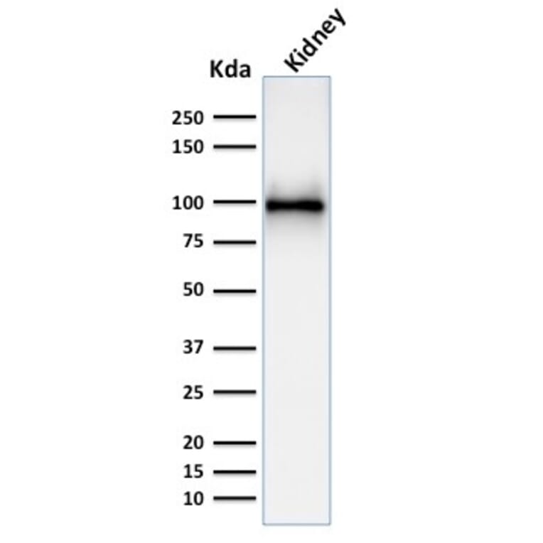 Western Blot - Anti-CD10 Antibody [MME/1892] - BSA and Azide free (A252535) - Antibodies.com