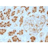 Immunohistochemistry - Anti-CD10 Antibody [MME/1893] - BSA and Azide free (A252536) - Antibodies.com