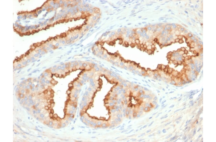 Immunohistochemistry - Anti-CD10 Antibody [MME/2579] - BSA and Azide free (A252536) - Antibodies.com