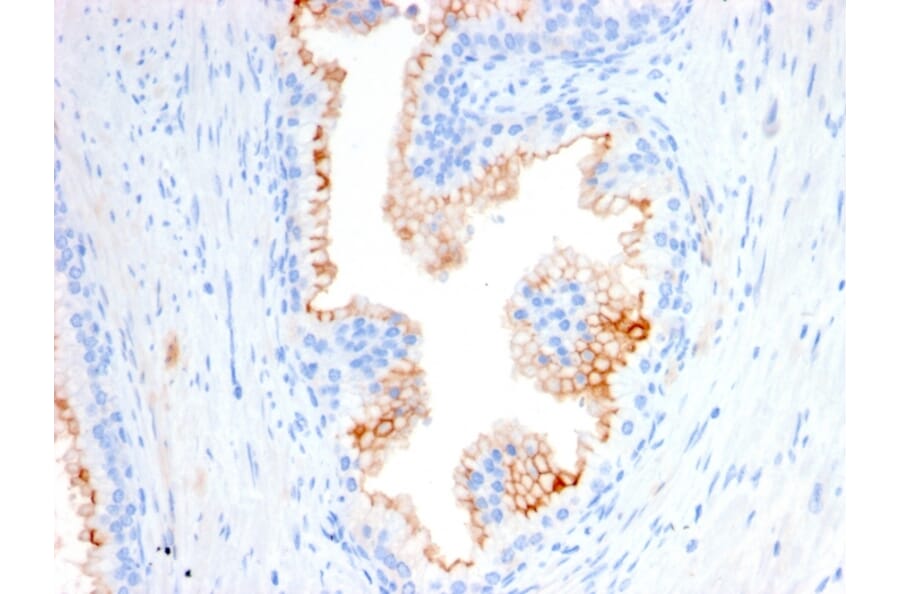 Immunohistochemistry - Anti-CD10 Antibody [MME/2580] - BSA and Azide free (A252538) - Antibodies.com