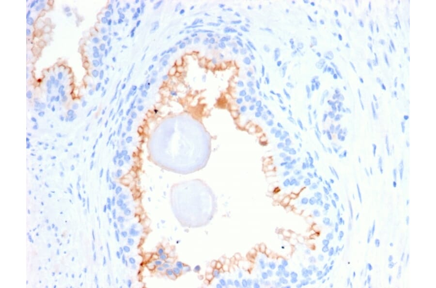 Immunohistochemistry - Anti-CD10 Antibody [MME/2580] - BSA and Azide free (A252537) - Antibodies.com