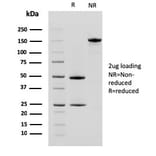 SDS-PAGE - Anti-CD10 Antibody [MME/2580] - BSA and Azide free (A252538) - Antibodies.com