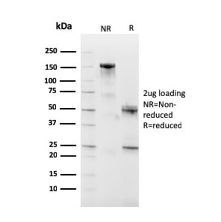 SDS-PAGE - Anti-CD10 Antibody [MME/2590] - BSA and Azide free (A252539) - Antibodies.com