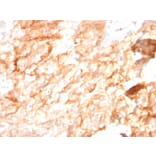 Immunohistochemistry - Anti-CD10 Antibody [MME/2590] - BSA and Azide free (A252539) - Antibodies.com